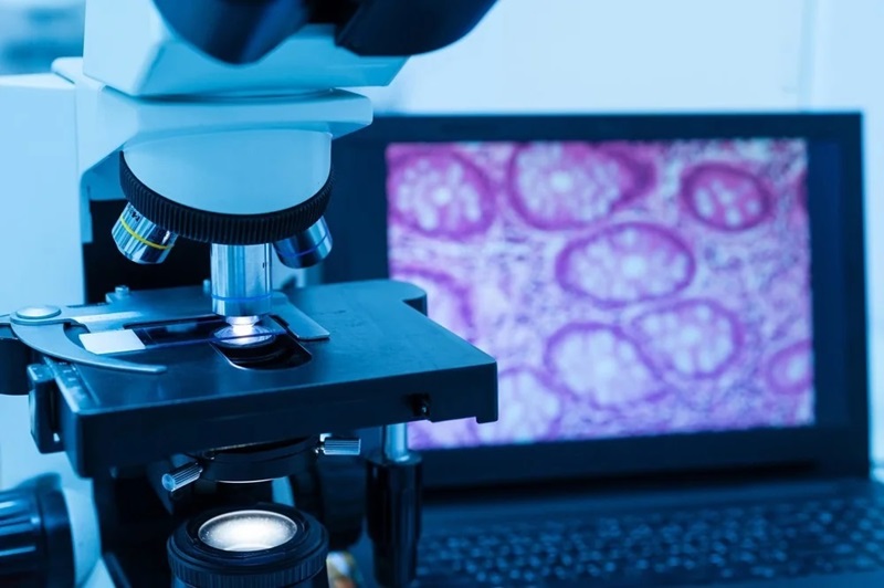 Workshop on High Resolution Digital Microscopy and its Applications